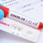 F0 test nhanh 1 vạch có thật sự hết COVID-19?